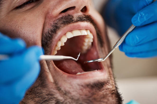 Best Emergency TMJ Treatment in Northwest Ithaca, NY